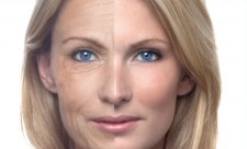 photoaging aging relief